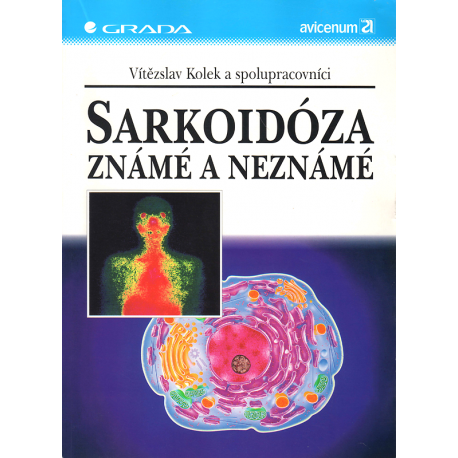 Sarkoidóza - známé a neznámé (KOLEK, V., a kol.)